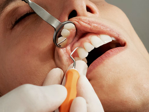 Удалить или оставить? Стоматолог поставил точку в вопросе сохранения зубов мудрости
