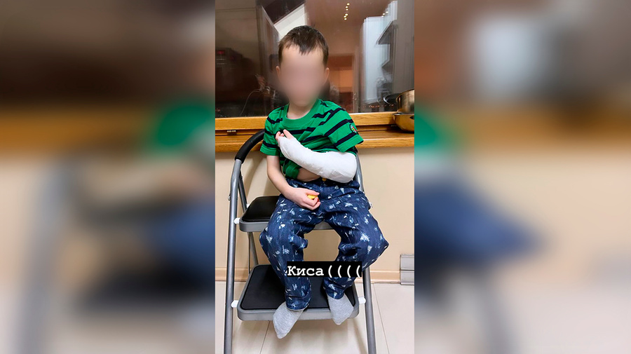 Ребёнок Миланы Тюльпановой и Александра Кержакова сломал руку в детском саду. Скриншот сториз © Instagram / milana_tulpanova