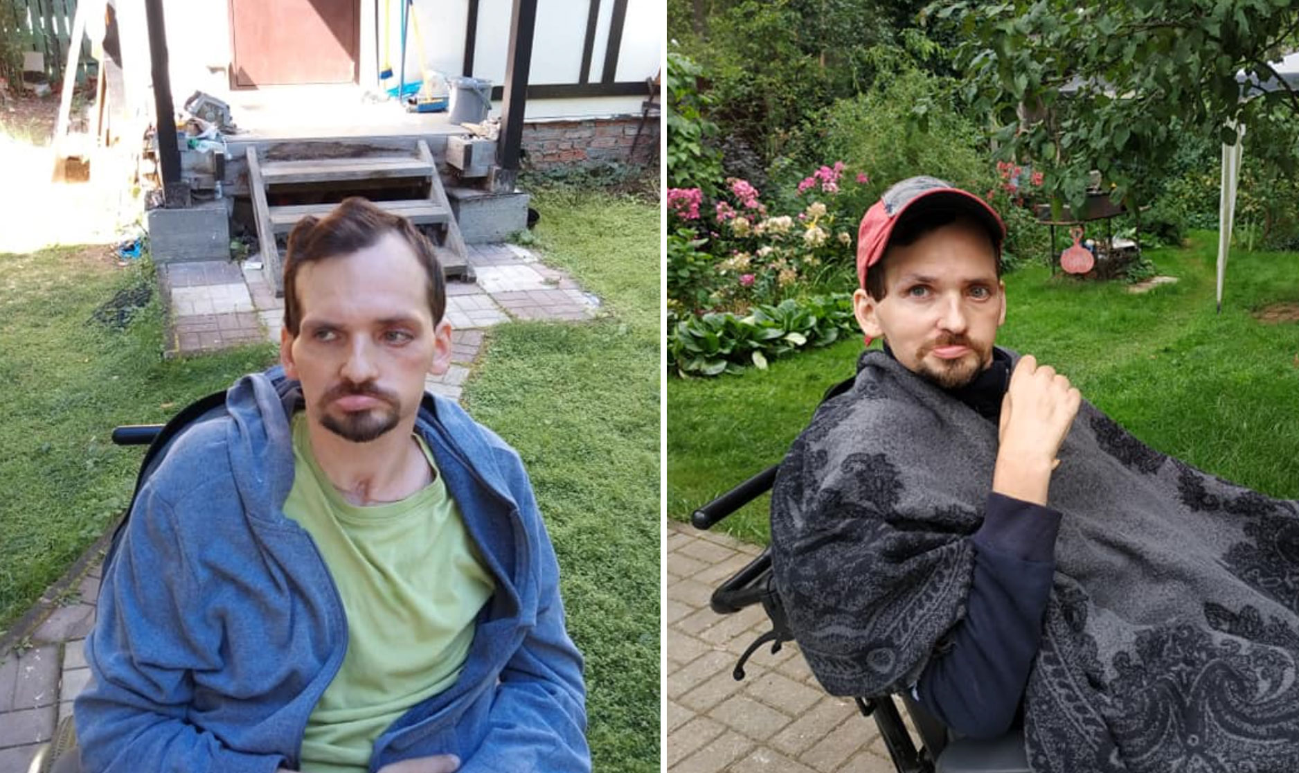 Как выглядит Алексей Янин после инсульта. Фото © facebook / Ольга Янина