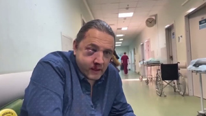 Экс-депутата Госдумы Максима Шингаркина избили в центре Москвы