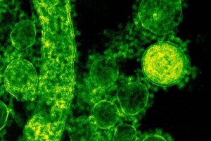 Вирусолог Волчков рассказал о новом способе "омикрона" проникать в клетки