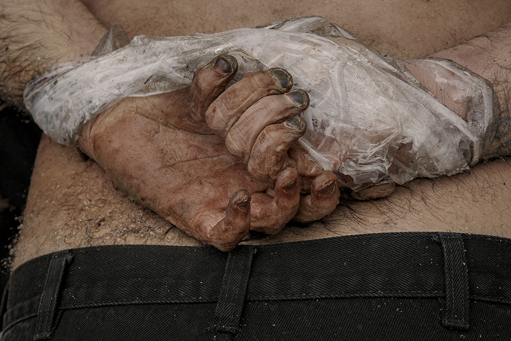 Труп с перевязанными руками, найденный в городе Буче, Украина. Фото © ТАСС / AP / Vadim Ghirda