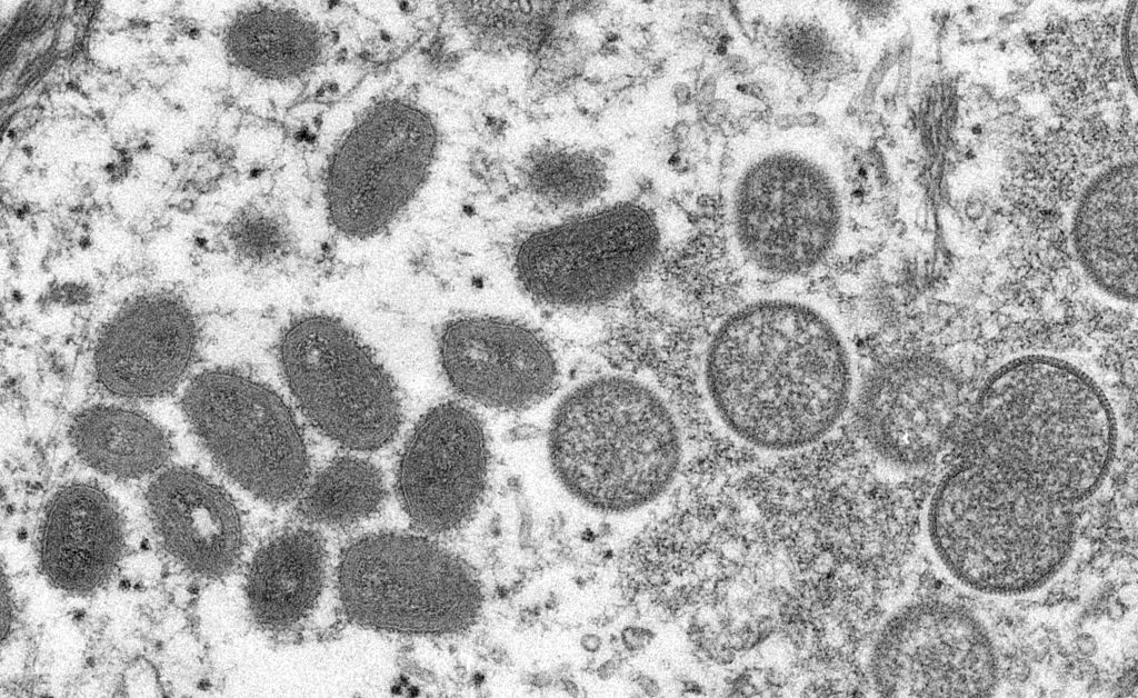 Вирус обезьяньей оспы. Электронно-микроскопическое изображение различных вирионов (вирусных частиц) вируса оспы обезьян, взятое с кожи человека, 2003 г. Фото © Getty Images / Smith Collection / Gado