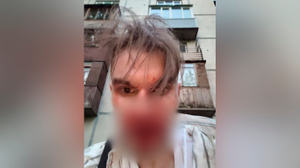 Неизвестные напали и избили сотрудника пресс-службы фракции партии "Яблоко" в Заксобрании Петербурга