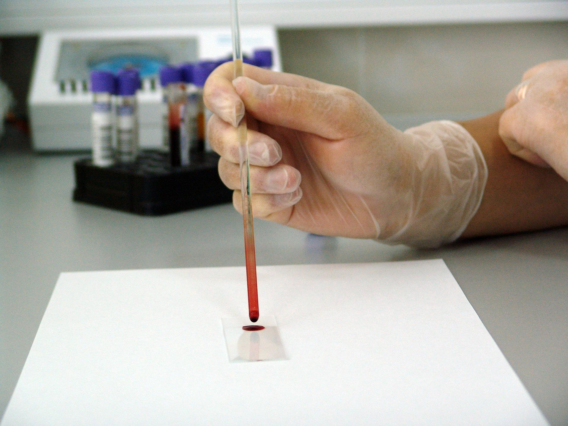 Учёные научились по крови вычислять потенциальных самоубийц