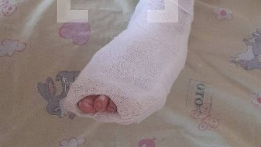 Фото травмированной ноги мальчика, которого отец выбросил из окна. Фото © VK / Типичный Екатеринбург