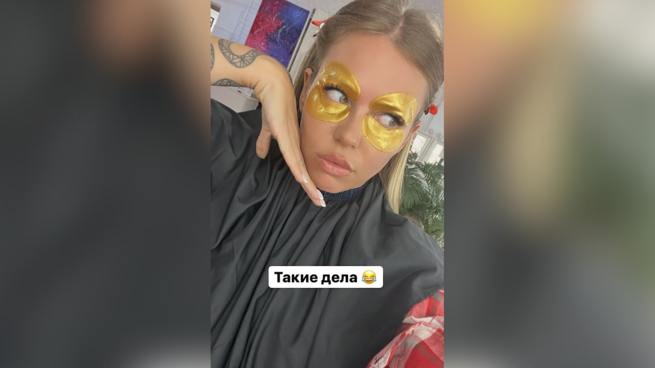 Рита Дакота после ринопластики перестала быть похожей на себя. Скриншот © Instagram (запрещён на территории Российской Федерации) / ritadakota
