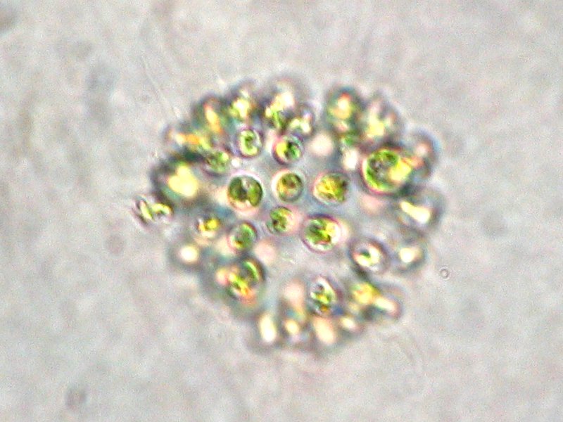 Колония ядовитых водорослей Microcystis aeruginosa под микроскопом. Фото © Wikipedia