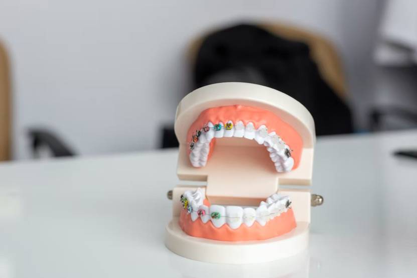 Стоматолог рассказал, как санкции повлияли на лечение зубов