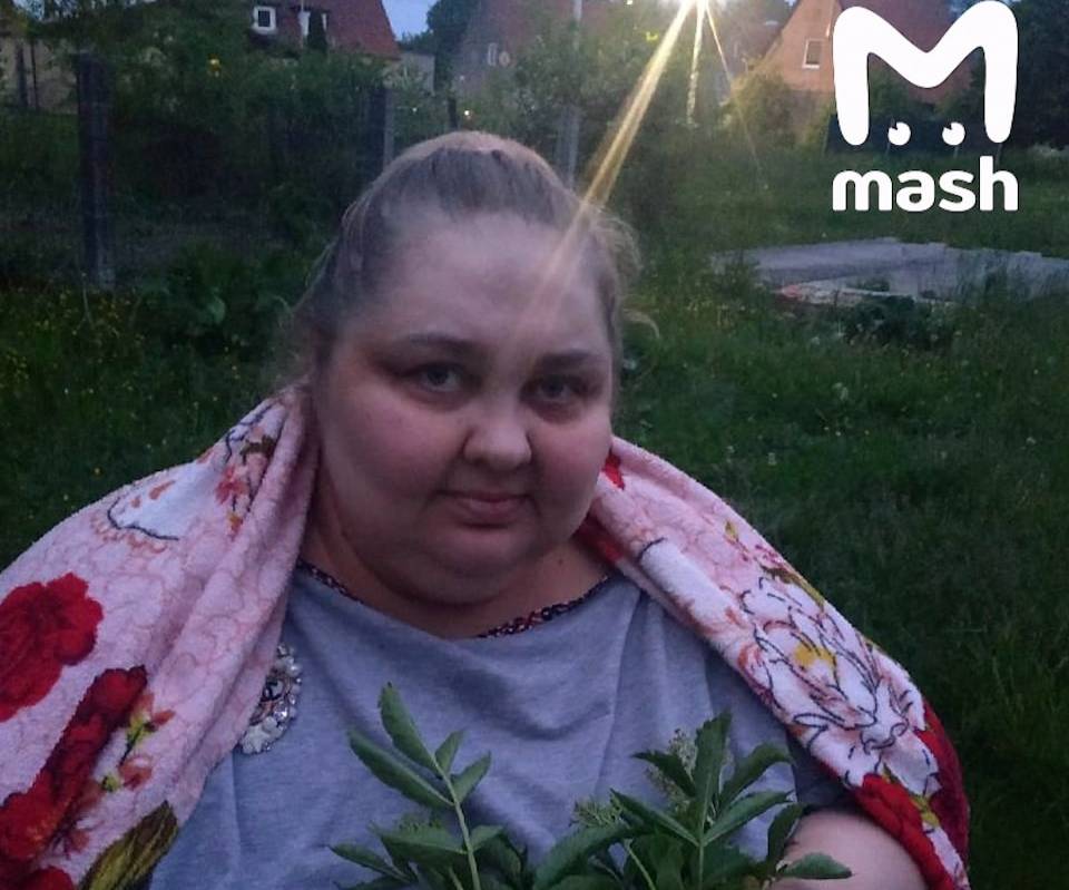 300-килограммовая россиянка скончалась, не дождавшись операции по снижению веса
