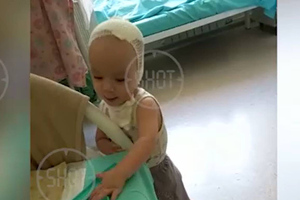 Кузбасские нейрохирурги заново собрали череп годовалому малышу с редким диагнозом