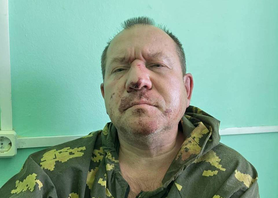 Член СПЧ Игорь Каляпин в больнице после нападения. Обложка © Telegram / Команда против пыток