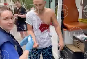 "Как самочувствие?" — "Пока стою": Лайф публикует видео с раненными при обстреле ВСУ центра Донецка