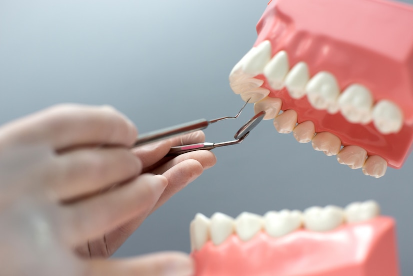 Какие услуги по лечению зубов можно получить бесплатно по полису ОМС в 2022 году