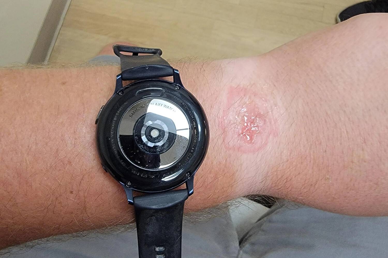 Умные часы от Samsung травмировали спящего пользователя