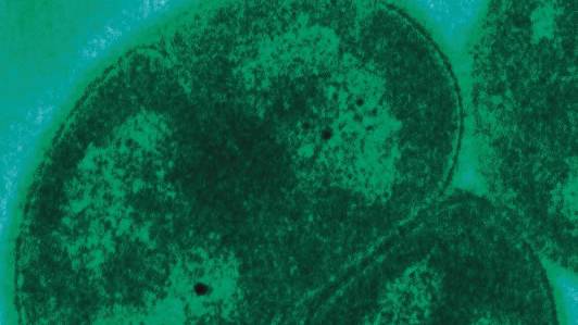 Бактерия Deinococcus radiodurans под микроскопом. Изображение © Wikimedia Commons / Uniformed Services University