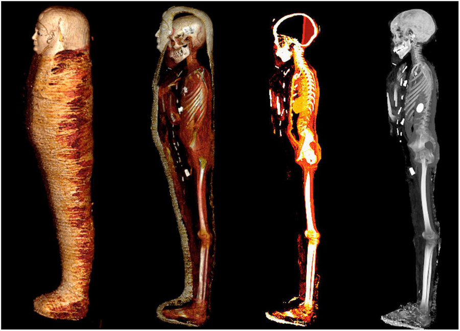 Томографии мумии "Золотой мальчик". Обложка © Frontiers in Medicine