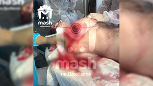 В Севастополе медики спасли военного, которому оторвало плечевой сустав в бою в зоне СВО