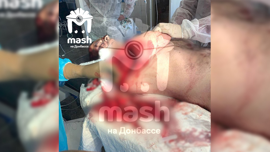Севастопольские медики спасли военного, которому оторвало плечевой сустав. Обложка © Telegram / "Mash на Донбассе"