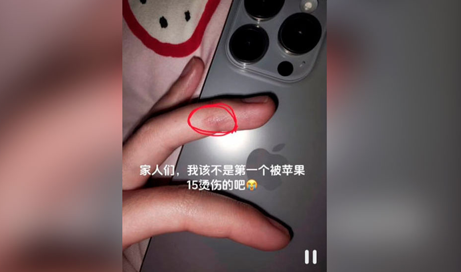 Пользовательница соцсетей утверждает, что получила ожог на пальце из-за своего iPhone 15 Pro, но проверить достоверность этих сведений невозможно. Фото © CNMO
