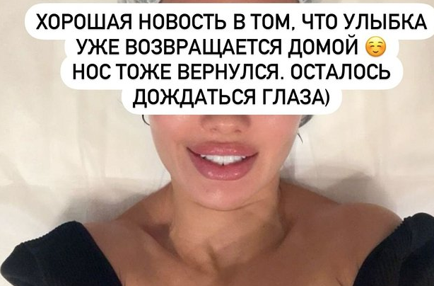 Виктория Боня после операции. Скриншот. Фото © Instagram (соцсеть запрещена в России) / victoriabonya