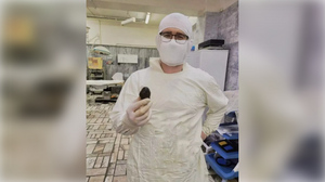В Омске хирурги удалили 86-летней пациентке желчный камень с куриное яйцо
