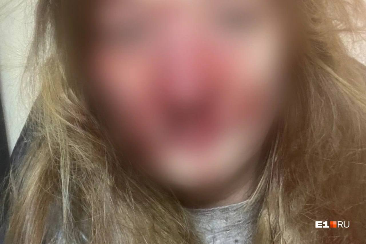 Пострадавшая Анастасия. Фото © Е1.ru