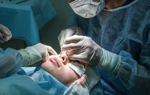 Делают даже мужчины: Хирург назвал самые популярные пластические операции у россиян