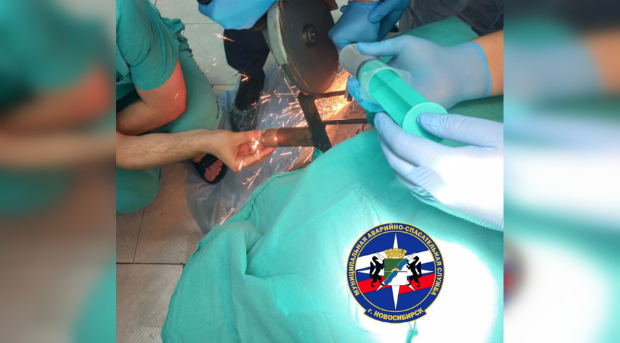 Новосибирские спасатели доставали вилы из головы мужчины прямо в операционной. Обложка © Telegram / Спасатели МАСС