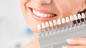 Голливудская улыбка: Врач перечислила безопасные процедуры для отбеливания зубов