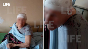 Работница курского дома престарелых разбила старушке голову за "излишнюю медлительность"