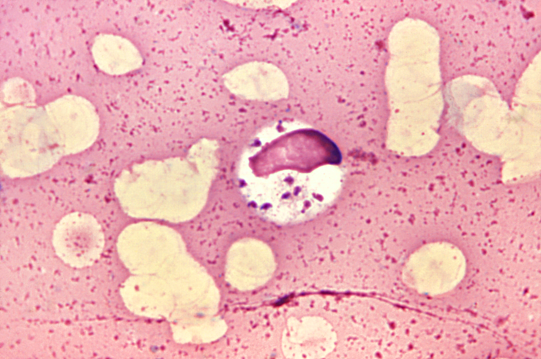 Leishmania donovani в мазке костного мозга. Фото © Wikipedia