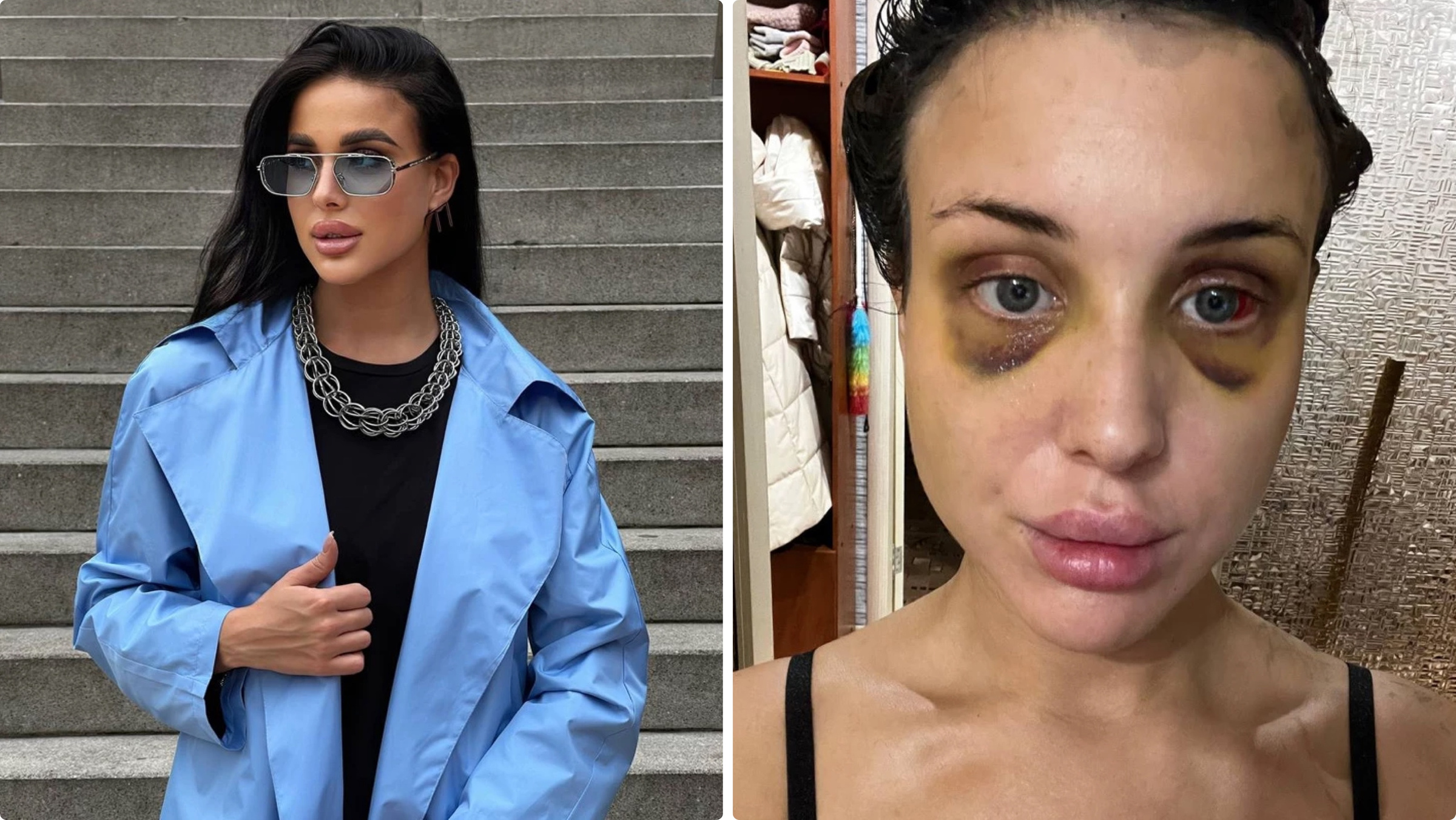 Пострадавшая Екатерина. Фото © E1