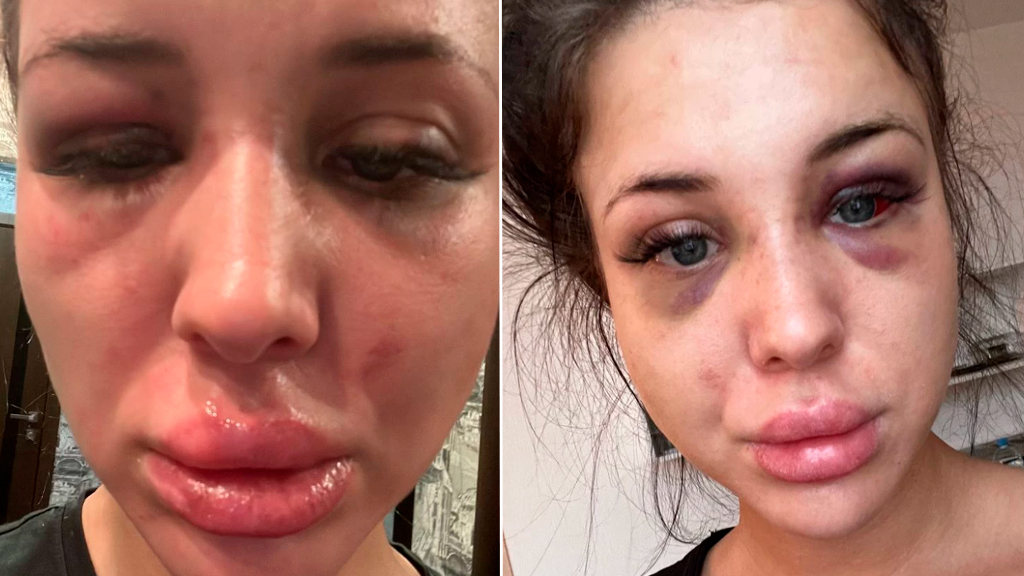 Пострадавшая Екатерина. Фото © E1