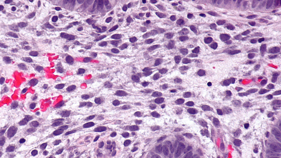 Эндометрий под микроскопом. Изображение © Wikimedia Commons / Nephron