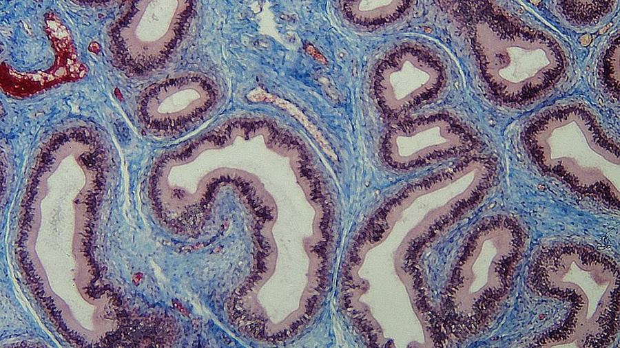 Соединительная ткань (голубого цвета) под микроскопом. Изображение © Wikimedia Commons / Rollroboter