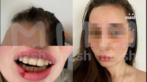 Россиянка Алёна после драки в фитнес-клубе с Сарой Окс. Фото © Telegram / Mash