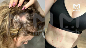 Актриса Сара Окс после драки в фитнес-клубе. Фото © Telegram / Mash