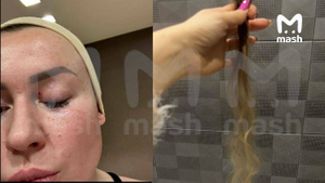 Актриса Сара Окс после драки в фитнес-клубе. Фото © Telegram / Mash