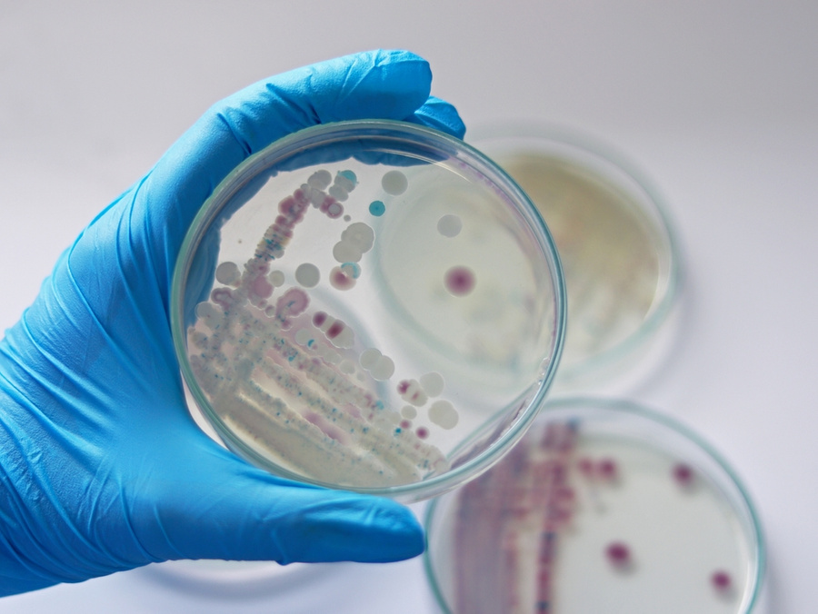 <p>Выращенные в лаборатории бактерии. Обложка © Shutterstock</p>