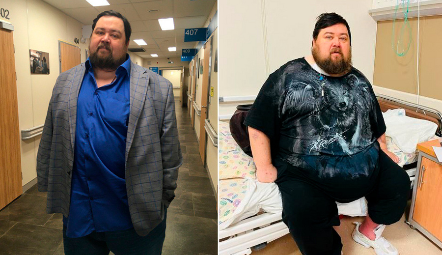 Алексей Николаев после операции (слева) и до (справа). Фото © газета "Петербургский дневник"