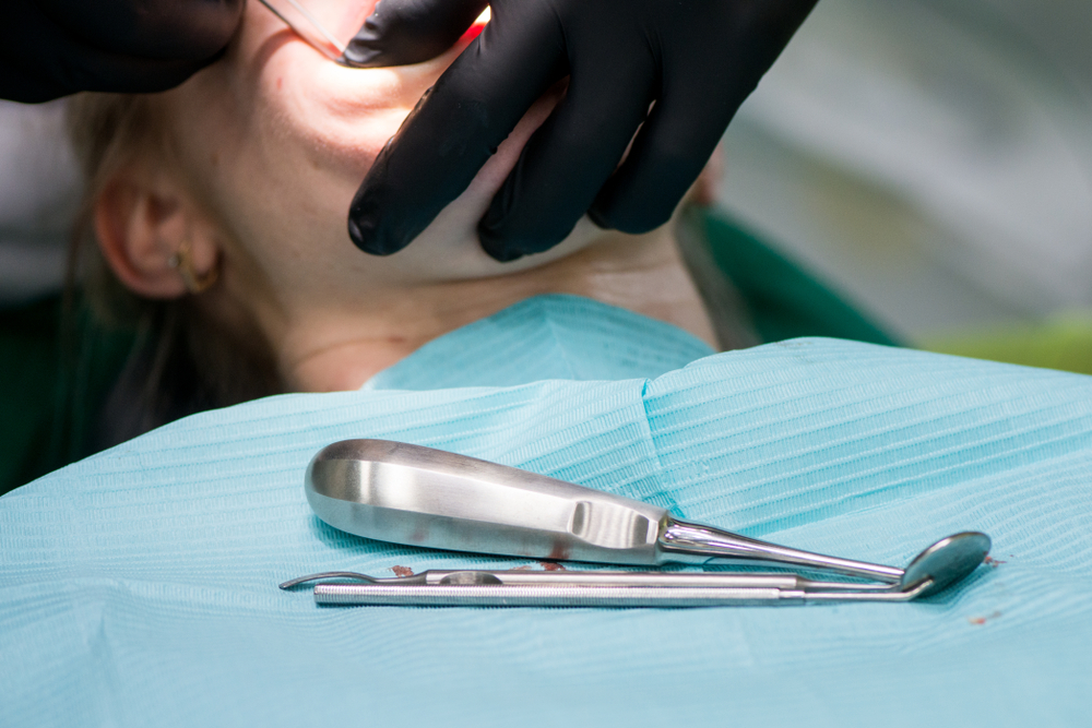 Стоматологи лишили россиянку 23 здоровых зубов и ввергли её в жуткие мучения
