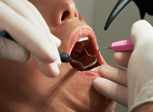 Стоматолог рассказала, кому ни в коем случае нельзя лечить зубы "во сне" 