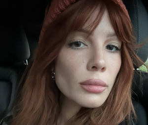 Косметолог рассказала, есть ли смысл мазать лицо грудным молоком, как певица Холзи