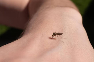 "Запахи имеют значение": Россиянам раскрыли необычный способ отпугнуть комаров