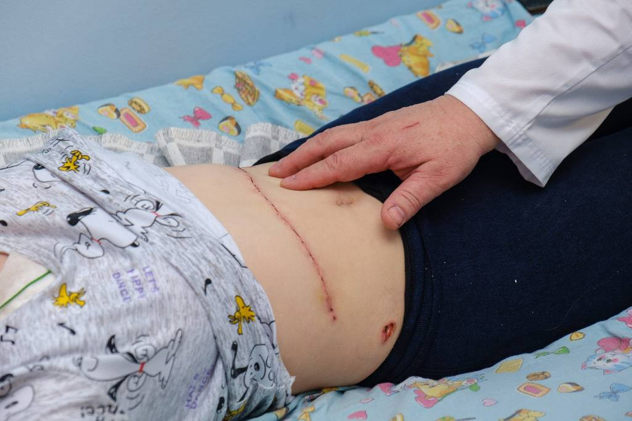 В Челябинске хирурги удалили 25-сантиметровую опухоль печени 15-летней девочке. Обложка © VK / ЧОДКБ