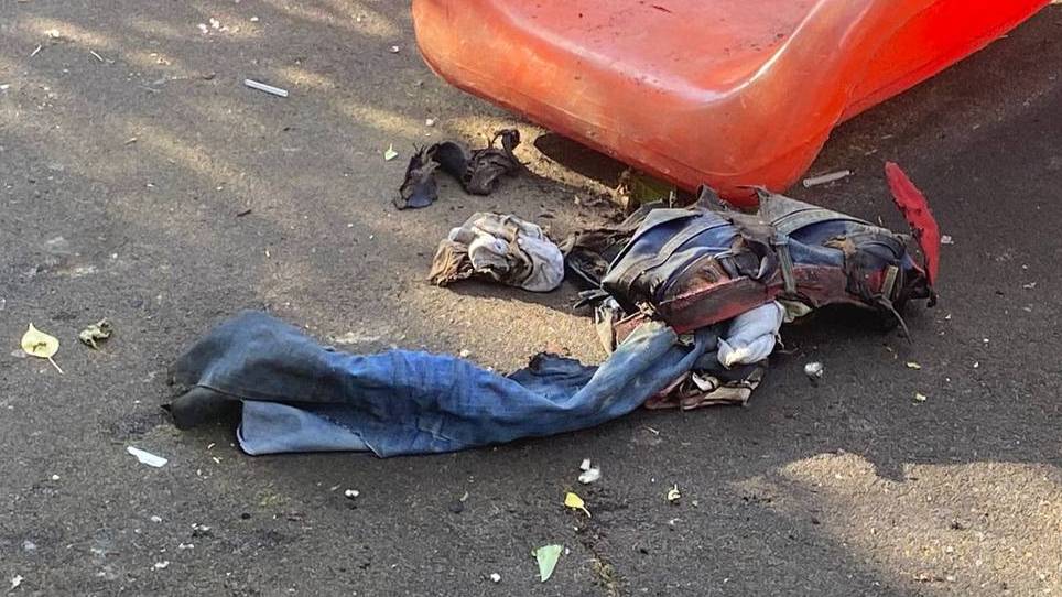 Умер подросток, которого облили бензином и подожгли на детской площадке в Москве