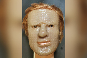 Создана уникальная "живая" маска для лечения ожогов