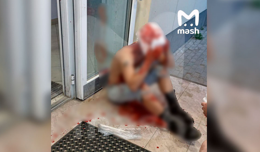 Фото окровавленного парня, которому неизвестные срезали скальп в подмосковной Электростали © Mash 
