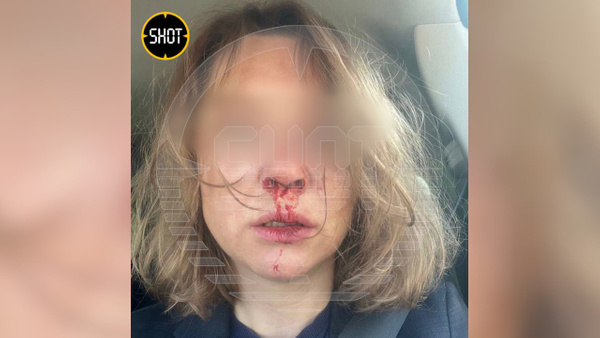 Бывшая жена Вадима Булавинова, которая обвинила его в избиении. Обложка © SHOT